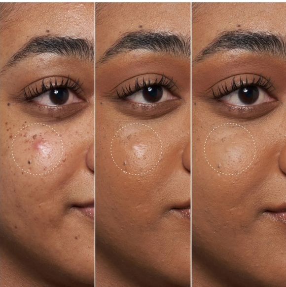 NIB Fenty Skin Blemish Defeat'r Spot Gel - Picture 5 of 7